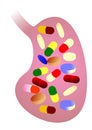 Stomach with pills