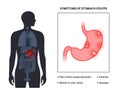 Stomach polyp disease