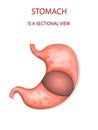 Stomach,sectional view