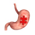 Stomach Surgery Concept. Human Stomach Anatomy Internal Organ with Red Jigsaw Puzzle Piece. 3d Rendering