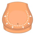 Stomach surgery correction icon, cartoon style