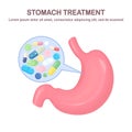 Stomach treatment. Pills, medicine, drugs and internal organ. Digestive system, tract. Painkiller, tablet, vitamine,