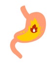 Stomach on a white background. Heartburn. Royalty Free Stock Photo