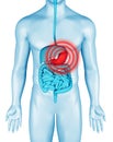 Stomachache on 3d illustration of male body. Stomach pain on anatomical digestive system infographic. Belly hurts illness.