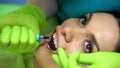Stomatologist applying blue gel on tooth, cosmetic dentistry, aesthetics