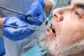 Stomatologist examining patient, close up.