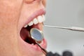 stomatologist examining patient's teeth, close up photo, corpped face.