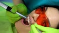 Stomatologist polishing fresh sealant, cosmetic dentistry for chipped tooth