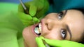 Stomatologist using mirror to examine patients tooth, professional work, closeup