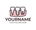 Stomatology, dental implant, denture and teeth, logo template. Medical, dental tooth, vector design. Dentistry