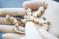 Stomatology healthcare dentist choosing dentures