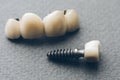 Stomatology healthcare denture dental crown