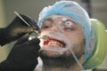 Stomatology healthcare - male patient at dentist`s chair