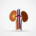 Stones in the kidney flat design icon