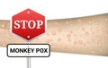 Stop monkey pox sigh board on blur infected hand