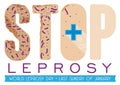 Stop Letters Depicting the Efficacy of Treatment against Leprosy, Vector Illustration