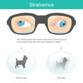 Strabismus. Meaning the condition abnormal neuromuscular control in which the eyes do not properly align with other when looking Royalty Free Stock Photo