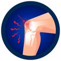 Dislocated knee cap icon. Vector flat design for radiology orthopedic research hospital for body joints