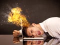 Stressed business man's head is burning Royalty Free Stock Photo