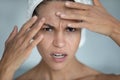 Stressed young mixed race woman worrying about skin problems. Royalty Free Stock Photo