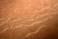 Stretch marks on the skin. Scars on the body. Stretch marks on legs. Cellulite. Royalty Free Stock Photo