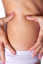 Stretch marks on female skin Royalty Free Stock Photo