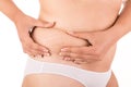 Stretch marks Royalty Free Stock Photo