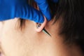 Stretching ears for larger diameter tunnels,piercer hand inserts the piercing in the ear Royalty Free Stock Photo