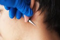 Stretching ears for larger diameter tunnels,piercer hand inserts the piercing in the ear Royalty Free Stock Photo