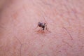 Striped mosquitoes are eating blood on human skin