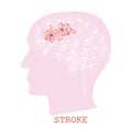 Stroke concept with human head silhouette