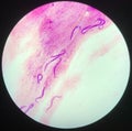 Strongyloides stercoralis parasit in human