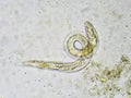 Strongyloides stercoralis