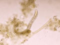 Strongyloides stercoralis or threadworm in human stool