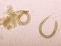 Strongyloides stercoralis or threadworm in human stool