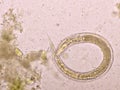 Strongyloides stercoralis or threadworm in human stool