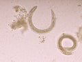 Strongyloides stercoralis or threadworm in human stool