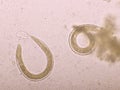 Strongyloides stercoralis or threadworm in human stool