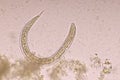 Strongyloides stercoralis or threadworm