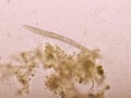 Strongyloides stercoralis or threadworm in human stool