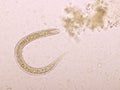 Strongyloides stercoralis or threadworm in human stool