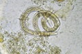 Strongyloides stercoralis