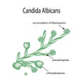Structure of Candida albicans. Infographics. Vector illustration on background