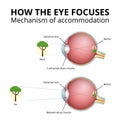 structure of the eyeball, lens accommodation mechanism Royalty Free Stock Photo