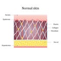 Structure human skin with collagen and elastin fibers, fibroblasts. Vector diagram