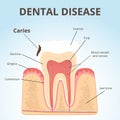 Structure of human teeth