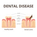 Structure of human teeth