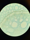 Structure of iris root, microscopic photography