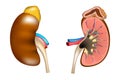 The structure of the kidneys and adrenal gland.