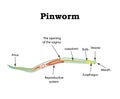 The structure of pinworms. Pinworm. Vector illustration on isolated background Royalty Free Stock Photo